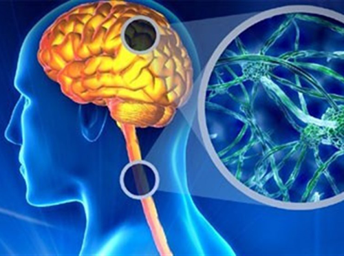 راه درمان بیماری ام اس