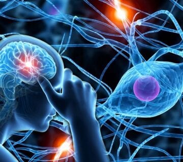 متخصص بیماری ام اس