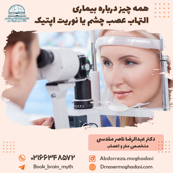 همه چیز درباره بیماری التهاب عصب چشم یا نوریت اپتیک