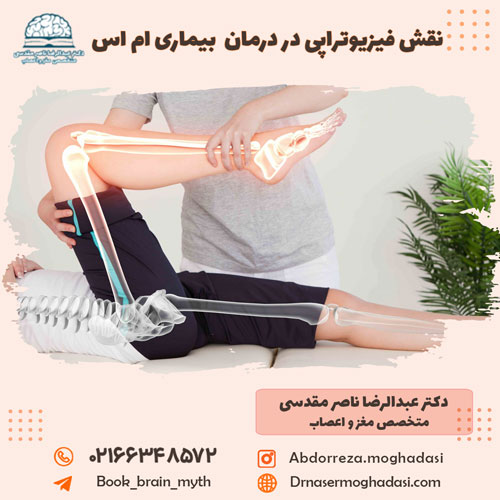 نقش فیزیوتراپی در درمان بیماری ام اس