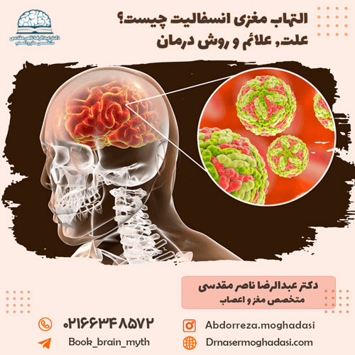 التهاب مغزی انسفالیت چیست؟ علت, علائم و روش درمان التهاب مغزی انسفالیت چیست؟ علت, علائم و روش درمان