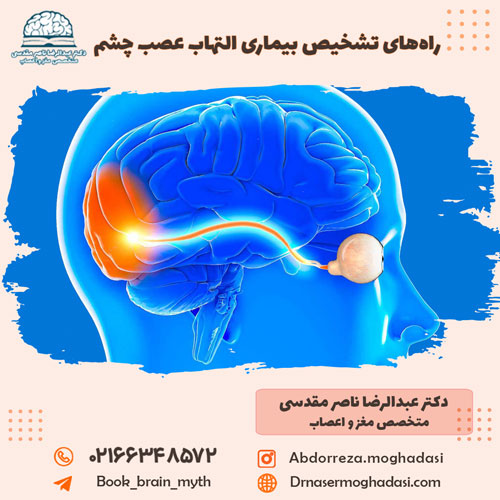 راه های تشخیص بیماری التهاب عصب چشم